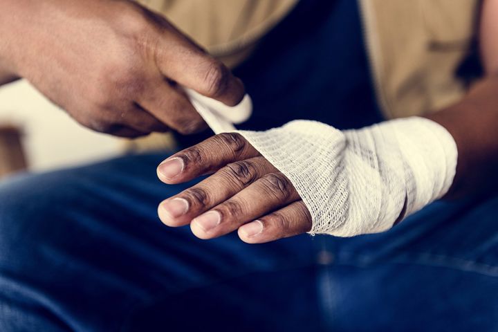 5 signs you need stitches