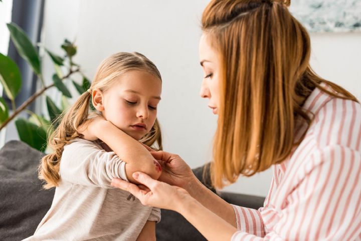 Top 5 summer injuries for kids
