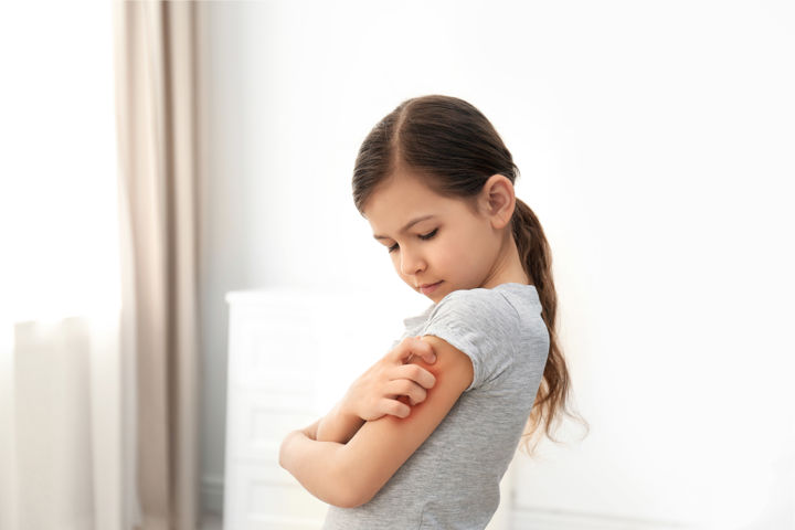 8 common skins conditions in kids: A parent’s guide 
